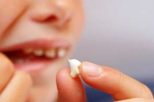 فقدان الأسنان – أسباب تساقط الأسنان و طرق العلاج و الوقاية