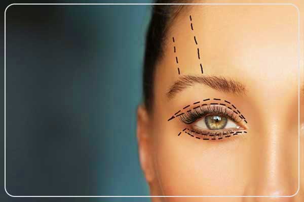 eyelid surgery in Turkey, blepharoplasty in Turkey, upper eyelid surgery Turkey, lower eyelid surgery Turkey, affordable eyelid surgery Turkey, best blepharoplasty surgeons Turkey, eyelid lift surgery Turkey, double eyelid surgery Turkey, transconjunctival blepharoplasty Turkey, cost of eyelid surgery in Turkey, best clinics for eyelid surgery Turkey, blepharoplasty before and after Turkey, non-surgical eyelid lift Turkey, medical tourism for eyelid surgery, cosmetic eye surgery Turkey , eyelid surgery, blepharoplasty, eyelid lift, Turkey cosmetic surgery, eye rejuvenation, plastic surgery Turkey, best eye surgeons, affordable blepharoplasty, vision correction surgery, upper and lower eyelid surgery, medical tourism Turkey, facial aesthetics, anti-aging surgery, best clinics in Turkey , how much is eyelid surgery in Turkey, is blepharoplasty worth it, best clinics for eyelid surgery in Turkey, how long does eyelid surgery last, does eyelid surgery leave scars, what is the recovery time for blepharoplasty, can I combine eyelid surgery with facelift, who is a good candidate for eyelid surgery, what are the risks of blepharoplasty, is eyelid surgery painful, how to prepare for eyelid surgery, best country for blepharoplasty, why choose Turkey for cosmetic surgery, how to find a certified plastic surgeon in Turkey