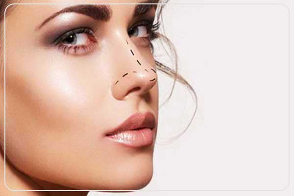 rhinoplasty in turkey, best rhinoplasty surgeons in turkey, affordable rhinoplasty in turkey, rhinoplasty cost in turkey, open vs closed rhinoplasty, best clinics for nose job in turkey, rhinoplasty recovery process, functional vs cosmetic rhinoplasty, medical tourism turkey, top plastic surgeons in turkey, nose job before and after turkey, rhinoplasty packages turkey , rhinoplasty, nose job turkey, best plastic surgeons turkey, medical tourism, cosmetic surgery turkey, rhinoplasty packages, nose reshaping, open rhinoplasty, closed rhinoplasty, revision rhinoplasty, non-surgical rhinoplasty, functional rhinoplasty, rhinoplasty cost, best clinics turkey, plastic surgery turkey , how much does rhinoplasty cost in turkey, is turkey good for rhinoplasty, how long is rhinoplasty recovery, is rhinoplasty in turkey safe, what are the best rhinoplasty clinics in turkey, what is the difference between open and closed rhinoplasty, how to choose the best rhinoplasty surgeon in turkey, how long to stay in turkey for rhinoplasty, do Turkish surgeons use modern rhinoplasty techniques, is rhinoplasty painful, can rhinoplasty fix breathing problems, how long does rhinoplasty surgery take, does rhinoplasty leave scars